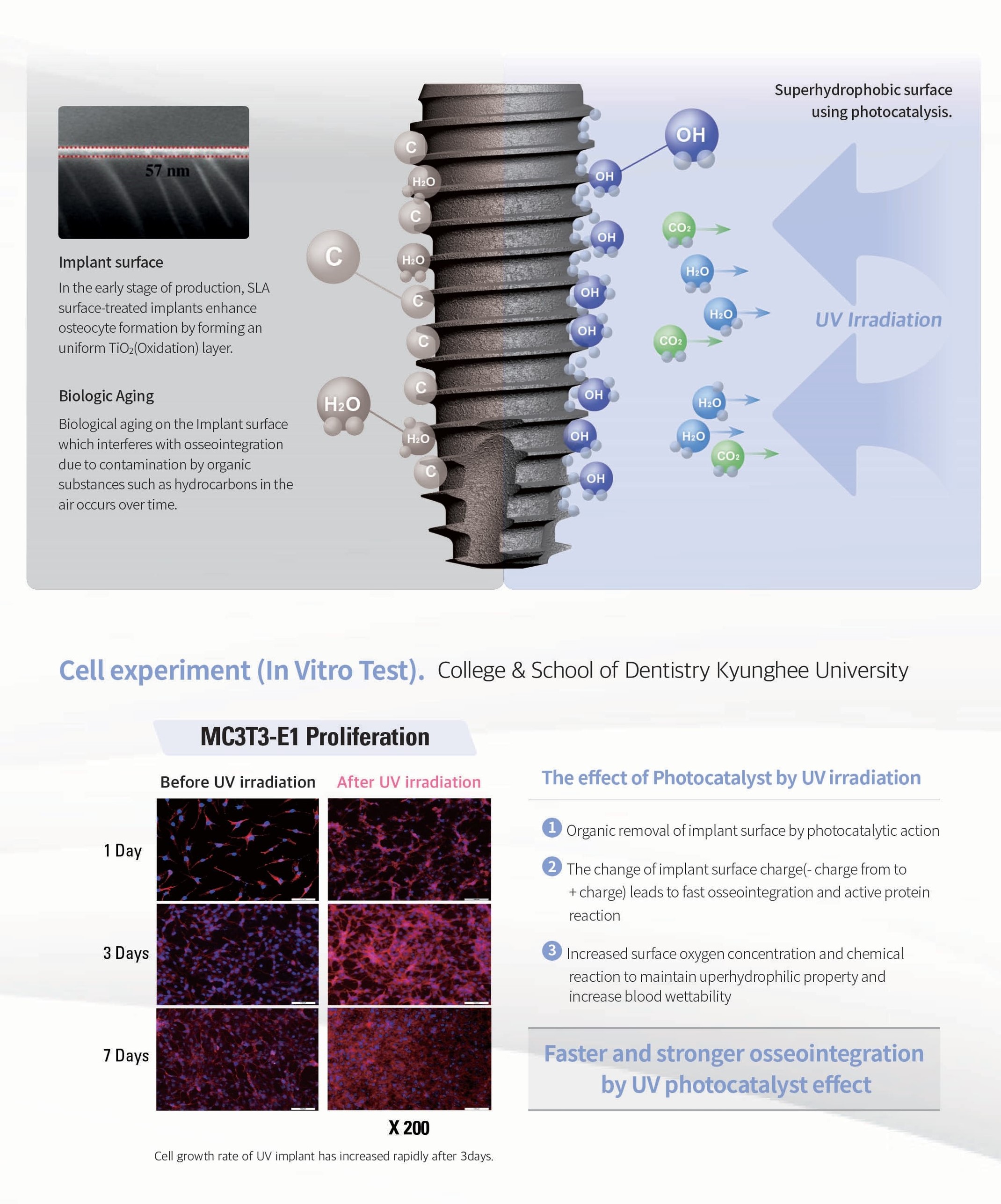 What is DIO Implant? (UFII & UV) Whitecap Dental Solution