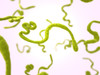 Ebola Virus Envelope Glycoprotein (GP) (Zaire, Boende-Lokolia)