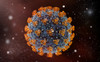 SARS Coronavirus Spike Glycoprotein (S1), His-Tag (HEK293)