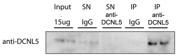 Anti Defective In Cullin Neddylation 1 Domain Containing 5 (DCUN1D5/DCNL5) Human full length pAb (Sheep, Affinity Purified)