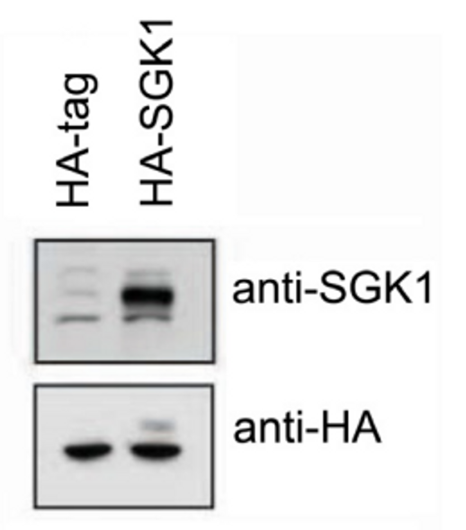 SGK1 (human; full length), pAb