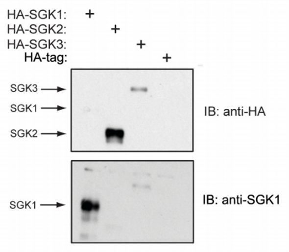 Anti Serum/Glucocorticoid Regulated Kinase 2 (SGK2) Human residues 412-431 pAb (Sheep, Affinity Purified)