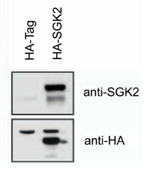 Anti Serum/Glucocorticoid Regulated Kinase 2 (SGK2) Human residues 333-346 pAb (Sheep, Affinity Purified)