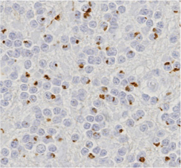Anti-C9ORF72 (Poly-GA) pAb (Rabbit, Antiserum)