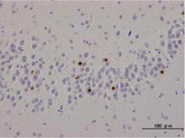 Anti TAR DNA-Binding Protein 43 (TDP-43), phospho-Ser409/410 mAb (Clone 11-9)