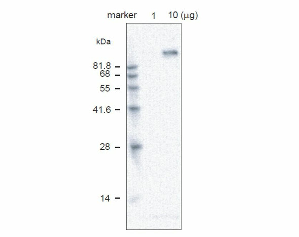 Anti Vacuolar-ATPase Subunit A (amino acids 117-135) pAb (Rabbit)