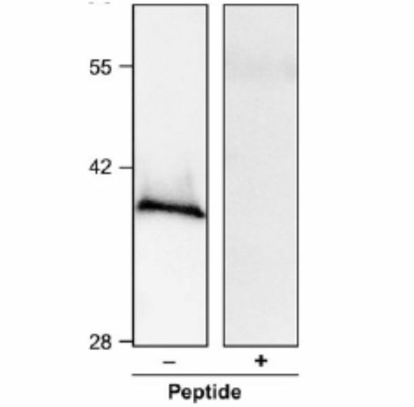 Anti Arabidopsis thaliana Plasma-Membrane Associated Cation-binding protein AtPCaP1 pAb (Rabbit)