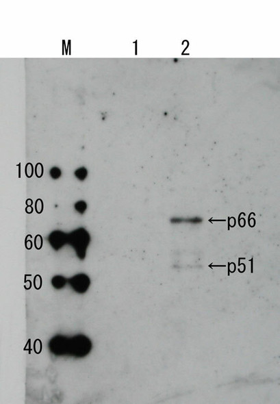 Anti HIV-1 Reverse Transcriptase pAb (Rabbit, Antiserum)