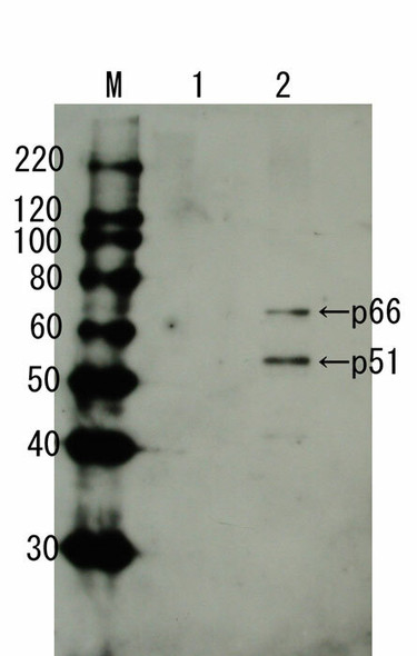 Anti HIV-1 Reverse Transcriptase pAb (Guinea Pig, Antiserum)
