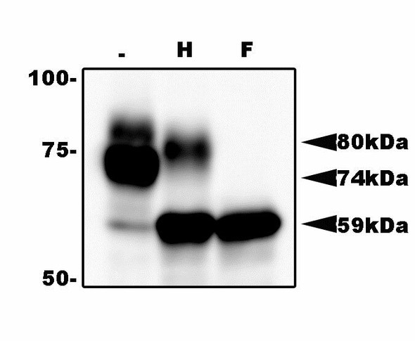 Anti Human Herpesvirus 6 Glycoprotein Q1 (gQ1) mAb (Clone 119)