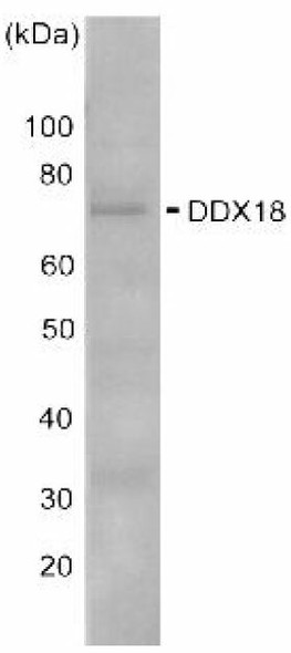 Anti ATP-Dependent RNA Helicase DDX18 pAb (Rabbit, Antiserum)
