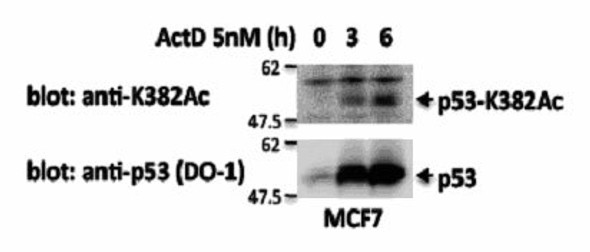 Anti Cellular Tumor Antigen p53 (TP53) acetyl-Lys382 mAb (Clone 2B7E4)