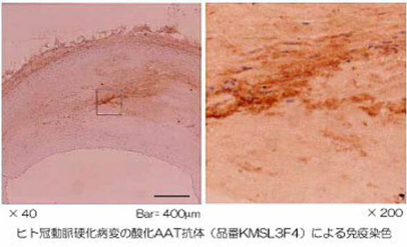 Anti Native ALPHA1 Antitrypsin mAb (Clone S3-1)
