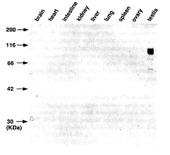 Anti GENA (Germ Cell-Specific Antigen) mAb (Clone TRA98)