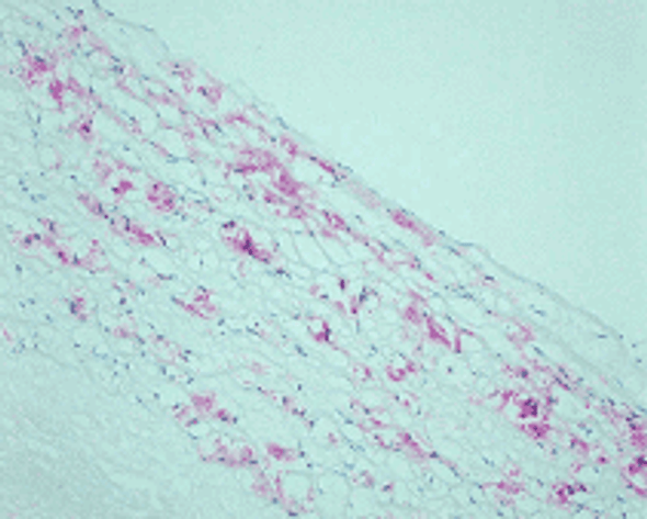 Anti CML mAb (Clone CMS-10, Biotin Labeled)