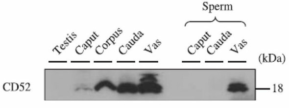 Anti CAMPATH-1 Antigen (CD52) pAb (Rabbit, Antiserum)