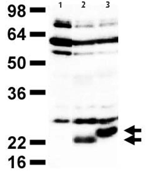 Anti Aph-1 Homolog A, Gamma-Secretase Subunit (APH1A) pAb (Rabbit, Affinity Purified)