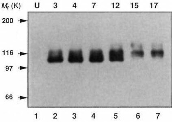 Anti Amyloid-Beta Precursor Protein (APP) C-terminal region pAb (Rabbit, Antiserum)