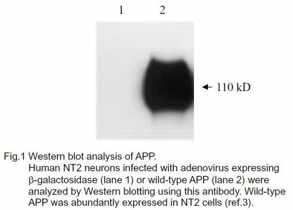 Anti Amyloid-Beta Precursor Protein (APP) N-terminal region pAb (Rabbit, Antiserum)