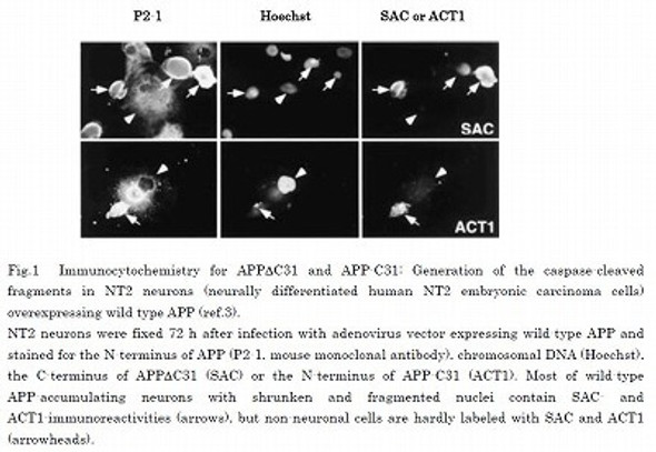 Anti Amyloid-Beta Precursor Protein-695 C-terminal 31 residue fragment (APP695-C31) pAb (Rabbit, Antiserum)