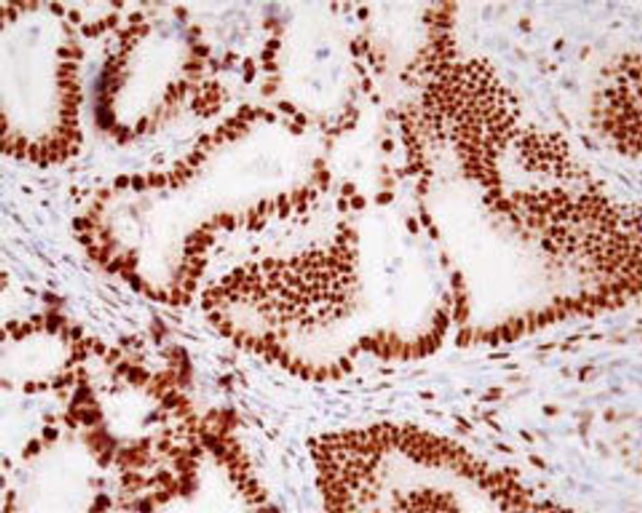 Anti Progesterone Receptor (PGR) common mAb (Clone A9621A)