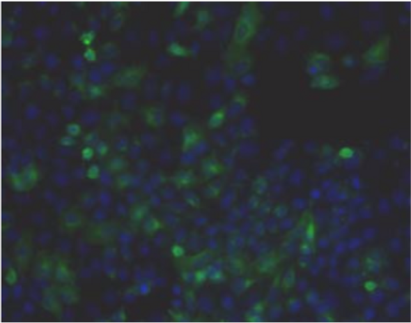 Anti Inter-Alpha-Trypsin Inhibitor Heavy Chain H4 (ITIH4) pAb (Brown Norway Rat, Antiserum)