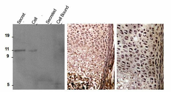 Anti Cartilage Oligomeric Matrix Protein (COMP) mAb (Clone 2127F5)