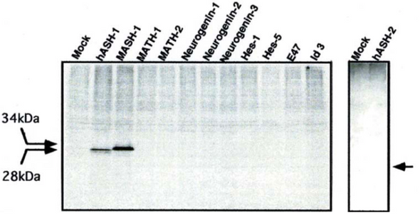Anti Achaete-Scute Homolog 1 (ASH-1/MASH-1) pAb (Rabbit, Antiserum)