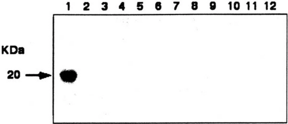 Anti Achaete-Scute Homolog 2 (ASH-2/MASH-2) pAb (Rabbit, Antiserum)