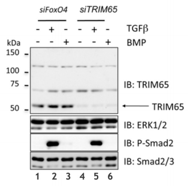 TRIM65 (human; full length), pAb