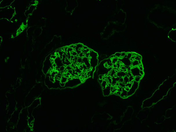 Anti Collagen 4 (ALPHA) 5 (IV) mAb (Clone B51, Fluorescein Labeled)