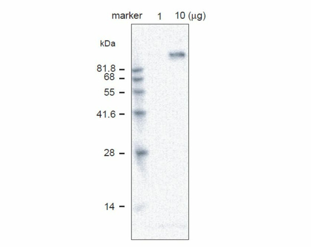 Anti Vacuolar-ATPase Subunit A (amino acids 117-135) pAb (Rabbit)