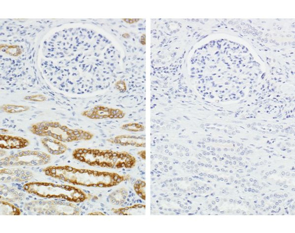 Human on Human Immunodetection Kit