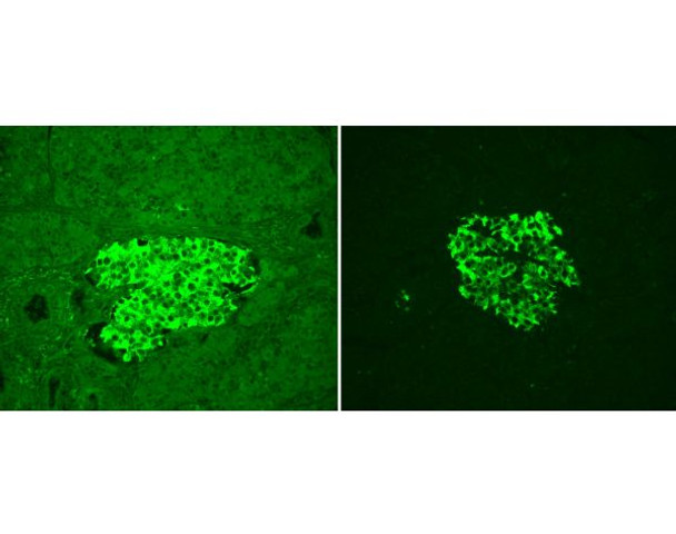 Vector[R] TrueVIEW[R] Autofluorescence Quenching Kit