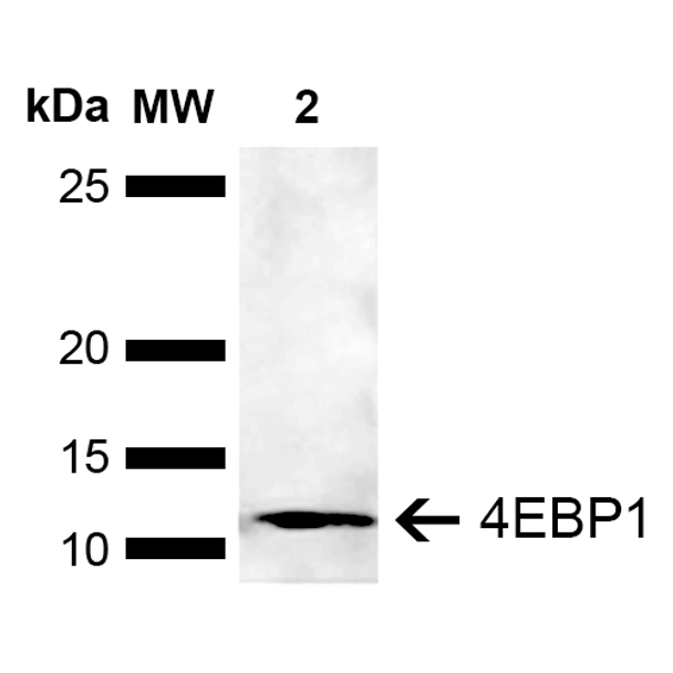 4EBP1 Antibody