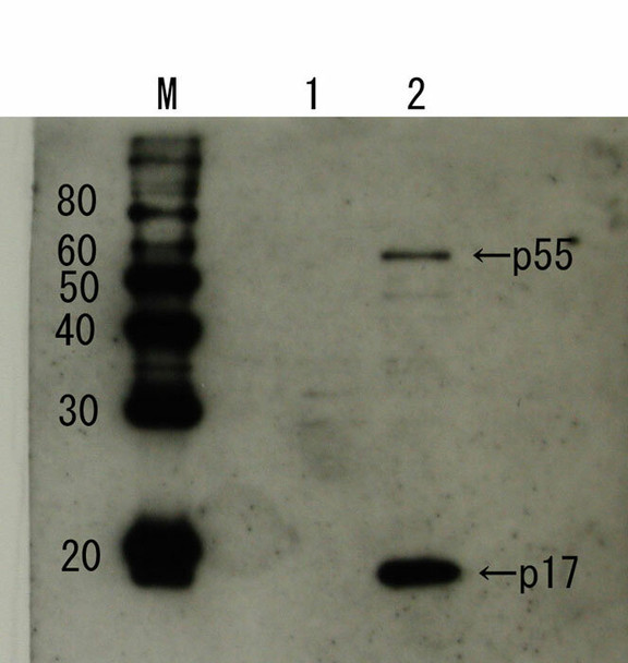 Anti HIV-1 Matrix Protein p17 pAb (Rabbit, Antiserum)