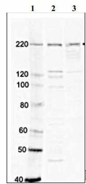 Anti Transcription Activator BRG1 (SMARCA4) pAb (Rabbit, Affinity Purified)