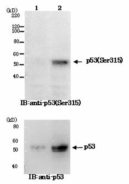 Anti Cellular Tumor Antigen p53 (TP53) phospho-Ser315 mAb (Clone 18)