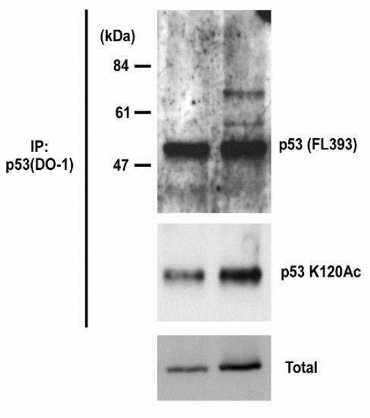 Anti Cellular Tumor Antigen p53 (TP53) acetyl-Lys120 mAb (Clone 10E5)