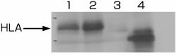 Anti HLA class I-A, B, C mAb (Clone EMR8-5)