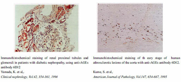 Anti AGEs mAb (Clone 6D12, Biotin Labeled)