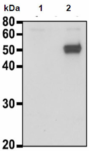 Anti Calreticulin (CALR/Calregulin) pAb (Rabbit, Antiserum)
