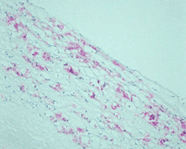 Anti CML mAb (Clone NF-1G, Biotin Labeled)