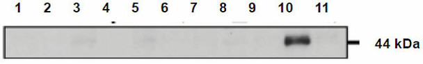 Anti Calreticulin-3 (CALR3/Calsperin) pAb (Rabbit, Antiserum)