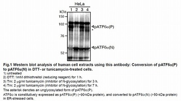 Anti Cyclic AMP-Dependent Transcription Factor ATF-6 Alpha (ATF6-alpha) mAb (Clone 37-1)