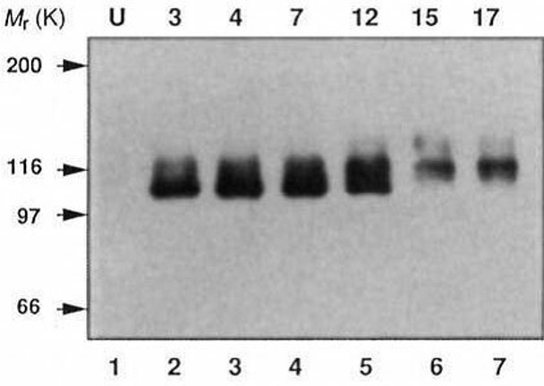 Anti Amyloid-Beta Precursor Protein (APP) C-terminal region pAb (Rabbit, Antiserum)