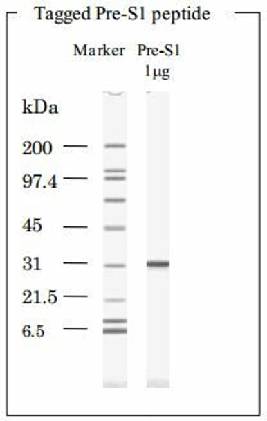HBV Surface Antigen (HBsAg) Pre-S1 peptide with Thioredoxin-His Tag
