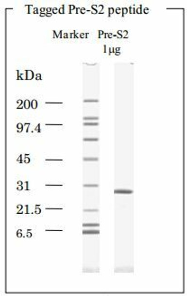 HBV Surface Antigen (HBsAg) Pre-S2 peptide Thioredoxin-His Tag