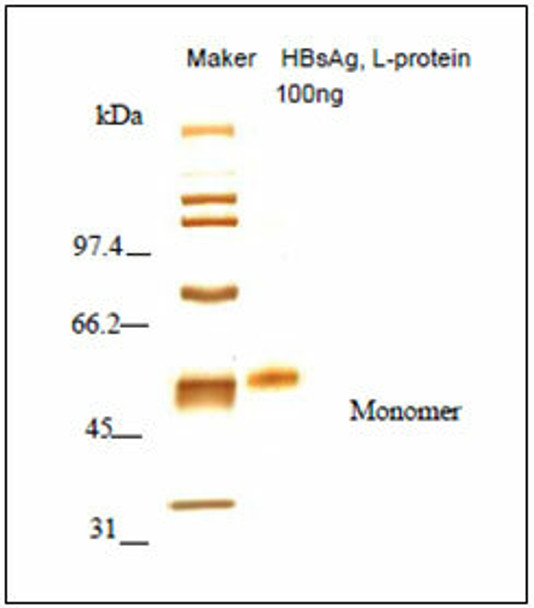 HBV Surface Antigen (HBsAg) L-protein (Recombinant)