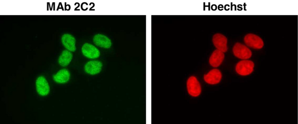 Anti SWI/SNF-related Matrix-associated Actin-dependent Regulator of Chromatin subfamily B member 1 (SMARCB1/INI1/BAF47) mAb (Clone 2C2)